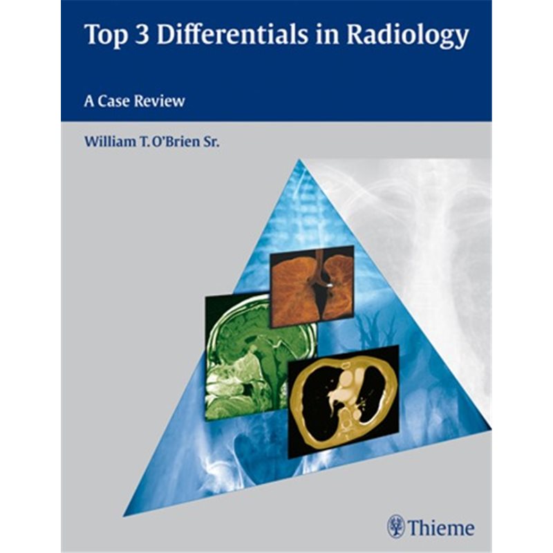 Top 3 Differentials in Radiology - A Case Review